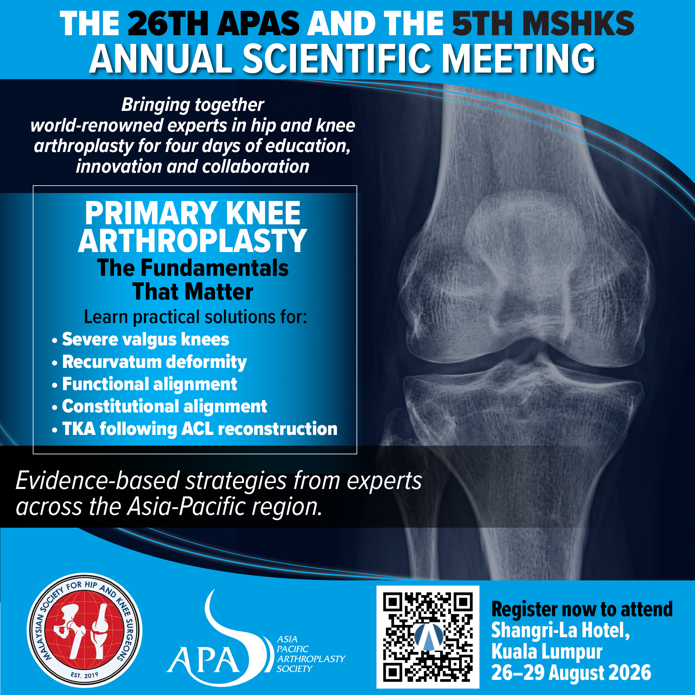 Primary Knee Arthroplasty – The Fundamentals That Matter